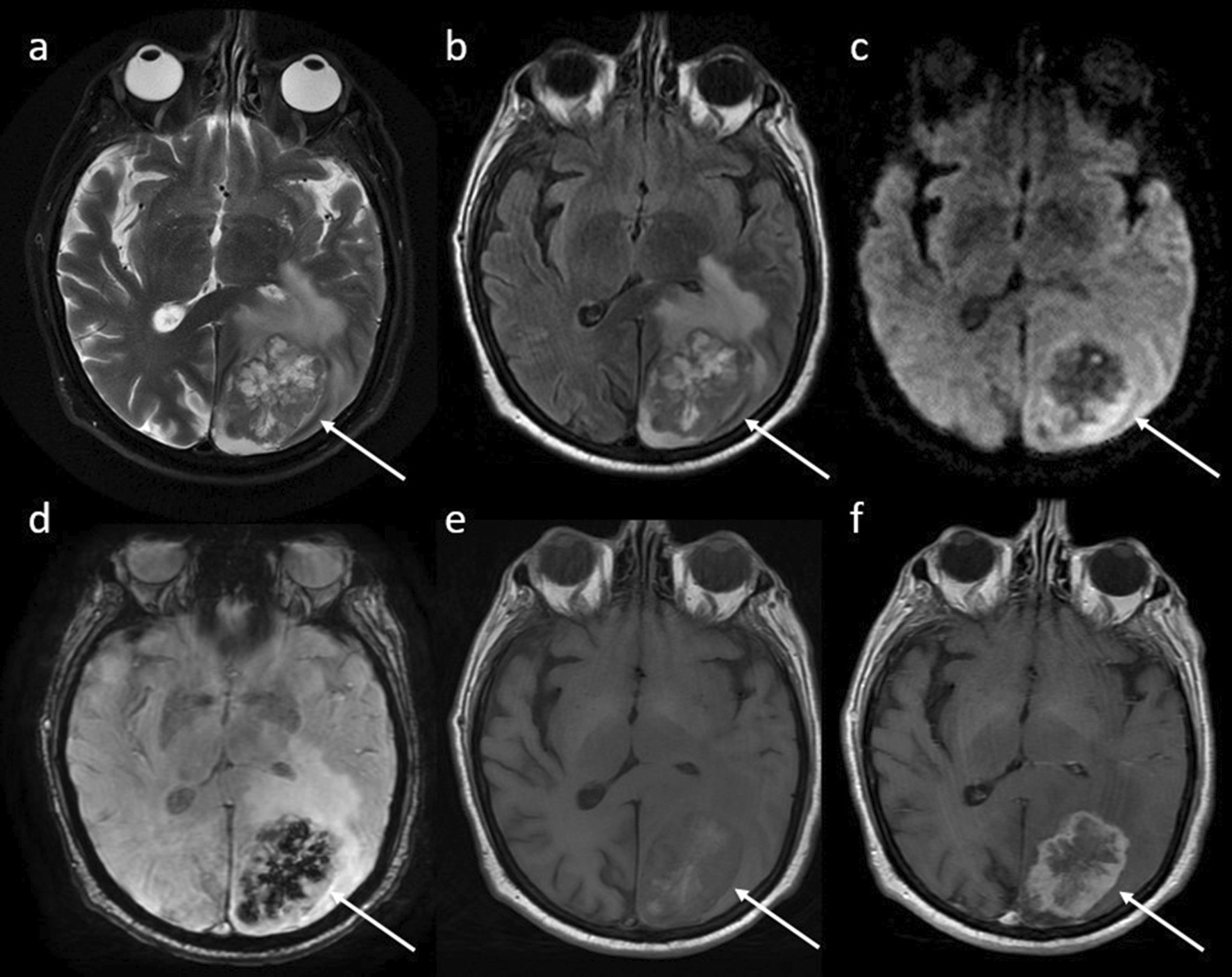 Fig. 10