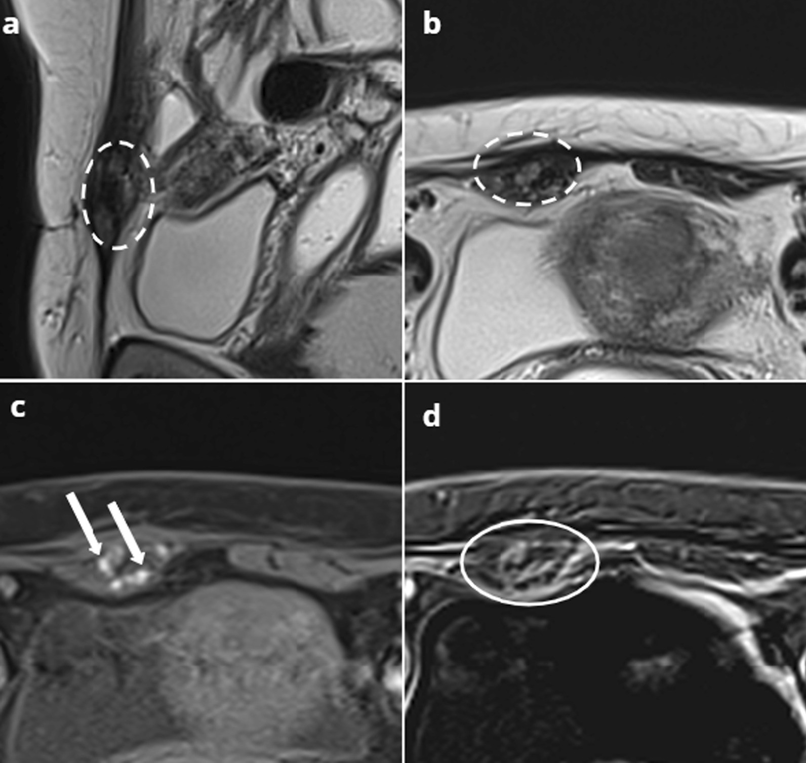 Fig. 11