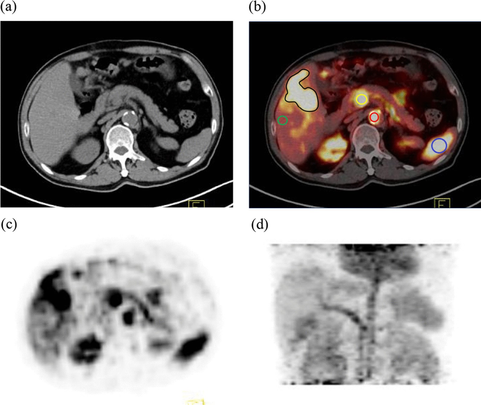 Fig. 1