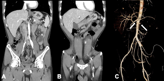 Fig. 4