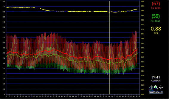 Fig. 4