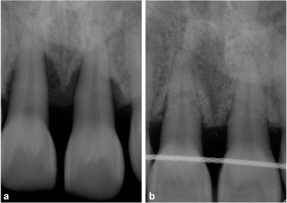 Fig. 5