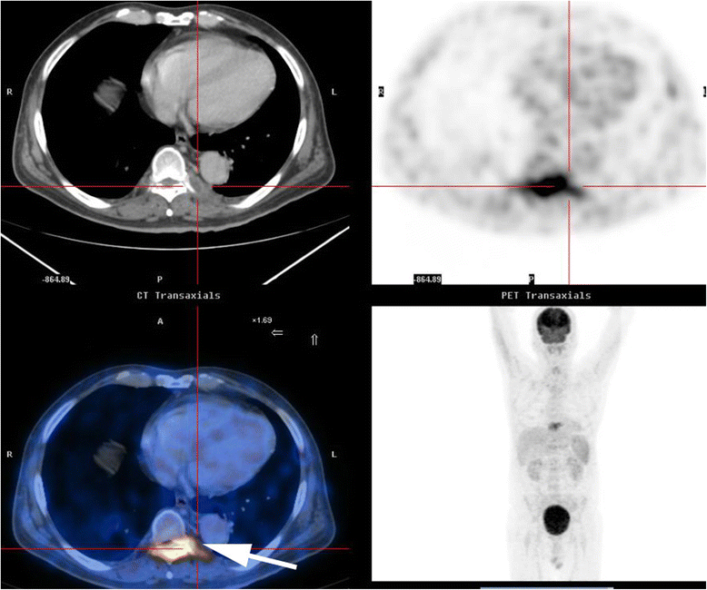 Fig. 2