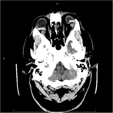 Fig. 1