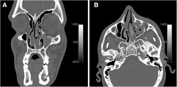 Fig. 5