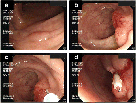 Fig. 1