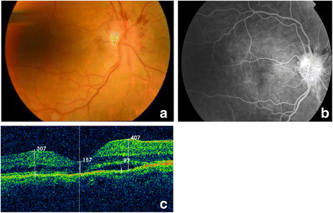 Fig. 1