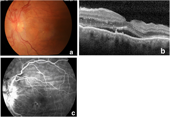 Fig. 3