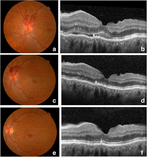 Fig. 4