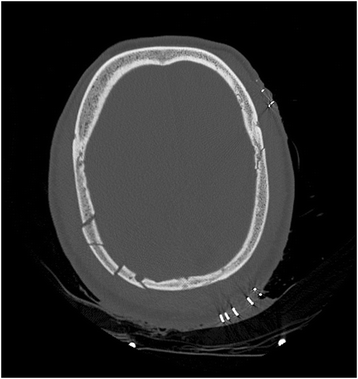 Fig. 2