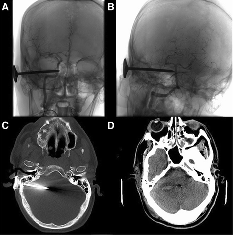 Fig. 5