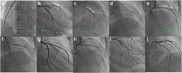 Fig. 3