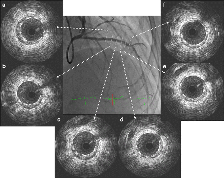 Fig. 5