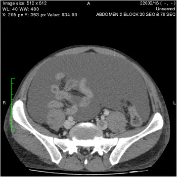 Fig. 10