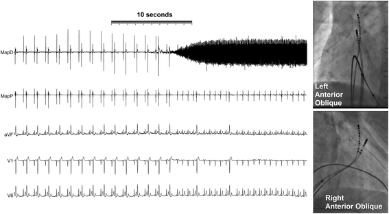 Fig. 2