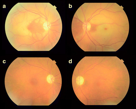 Fig. 1