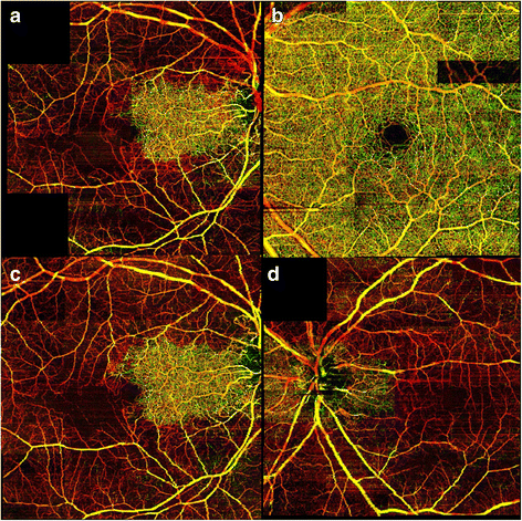 Fig. 3