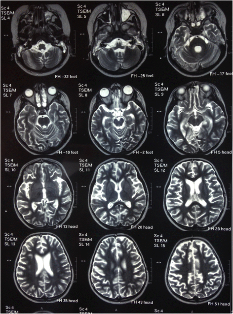 Fig. 8