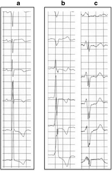 Fig. 2