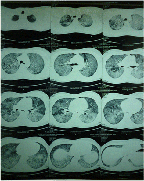 Fig. 2