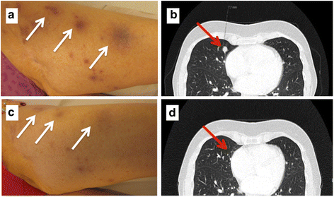 Fig. 4