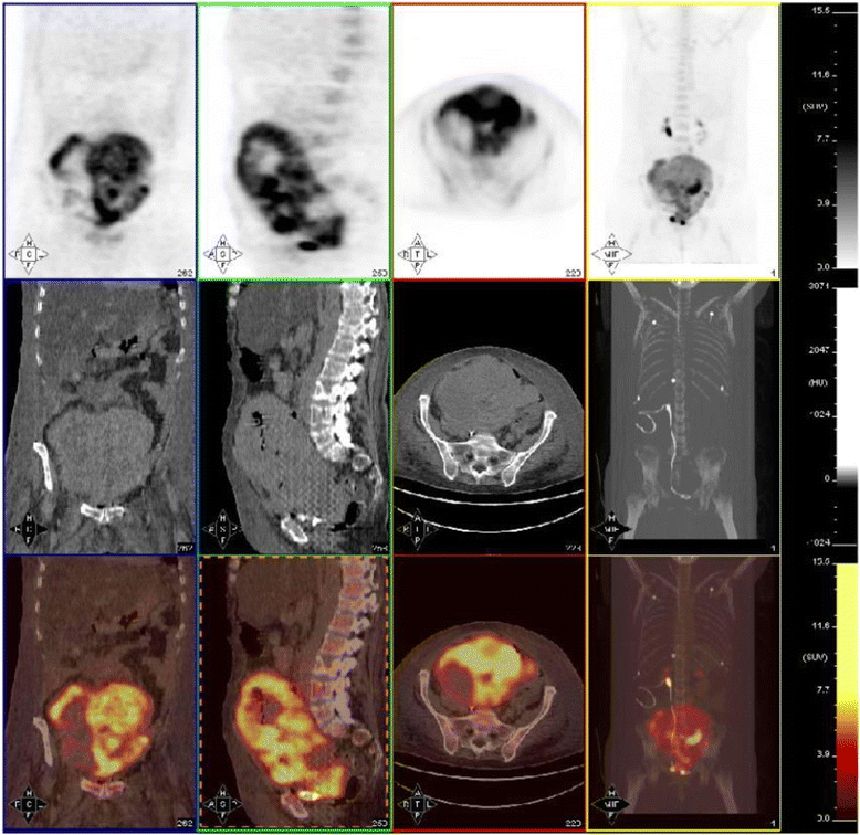 Fig. 2