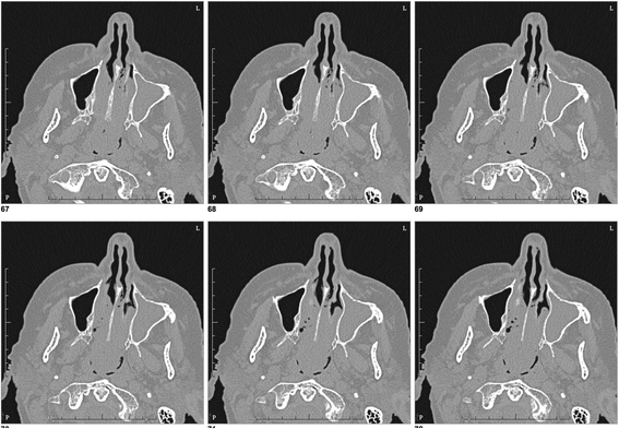 Fig. 1