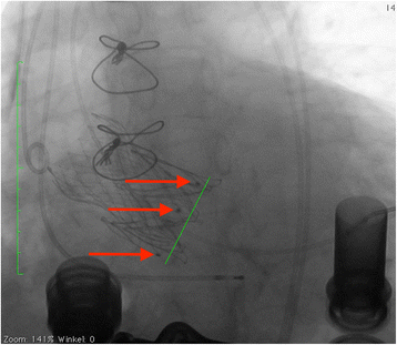 Fig. 5