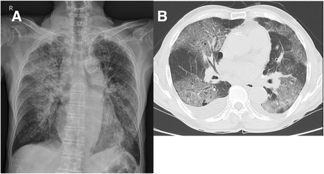 Fig. 1