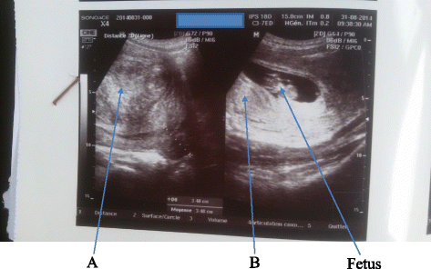 Fig. 1