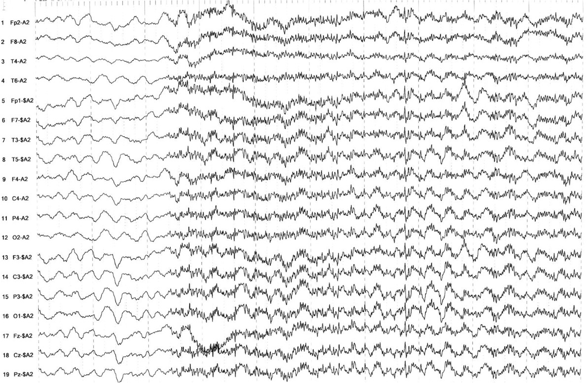 Fig. 2