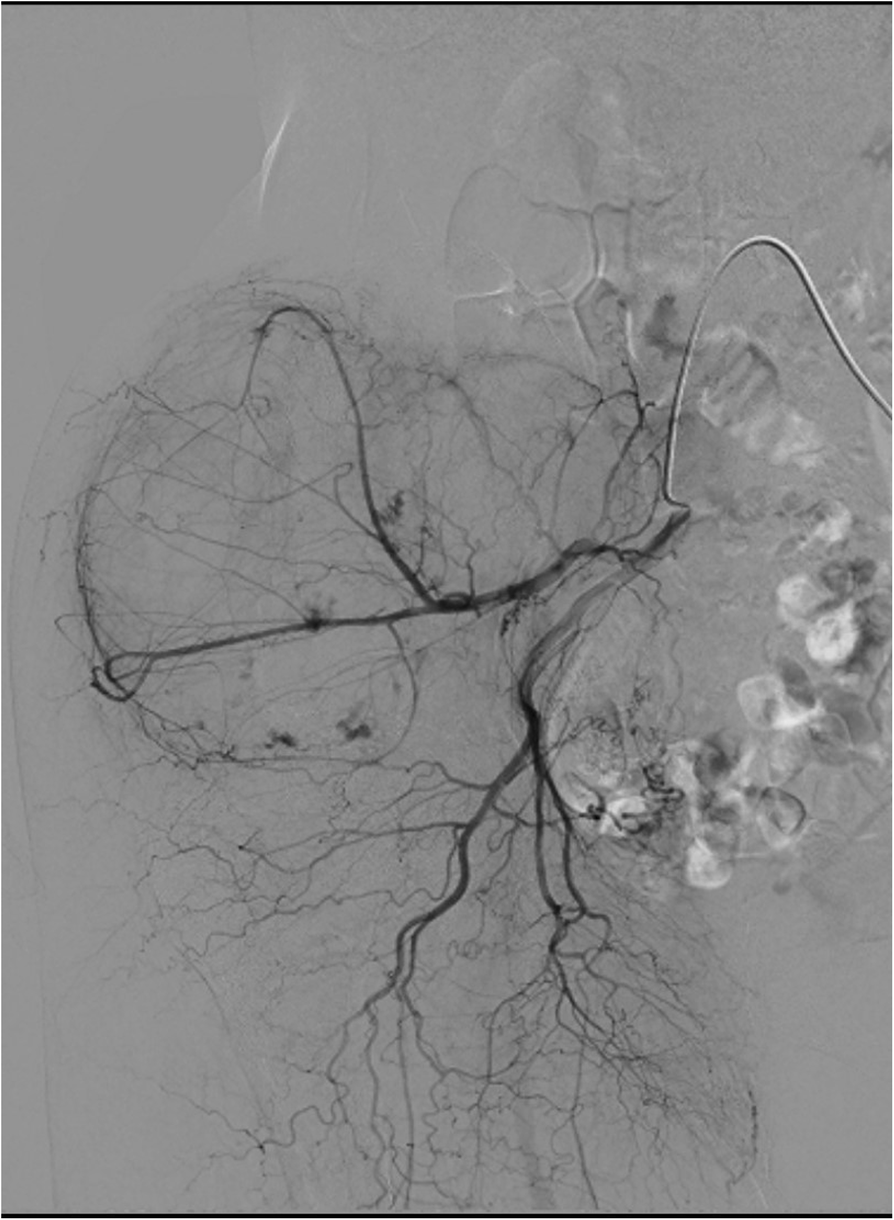 Fig. 5