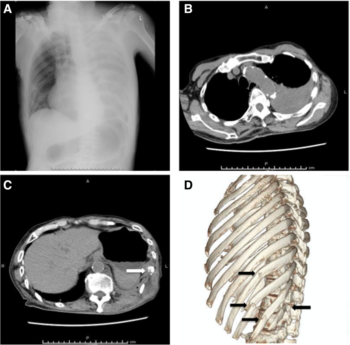 Fig. 1