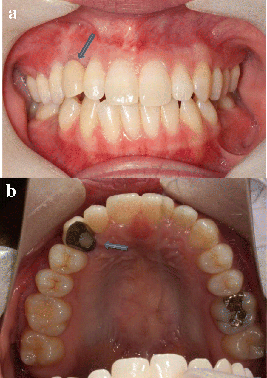 Fig. 10