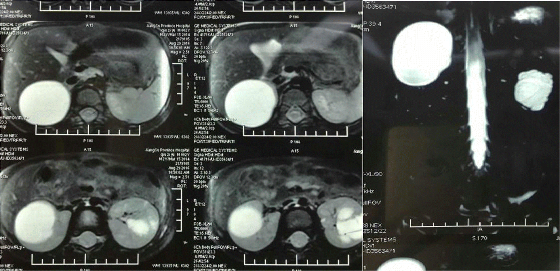 Fig. 1