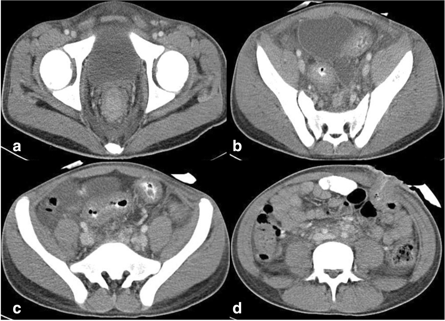 Fig. 3