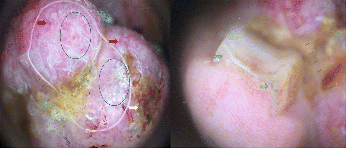 Fig. 2