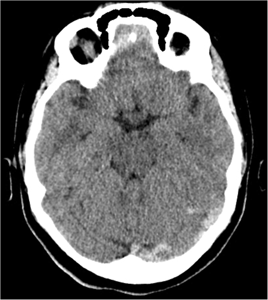 Without scan. Without scan. Сканер красивый. Ct without contrast agent. Ct scan report.