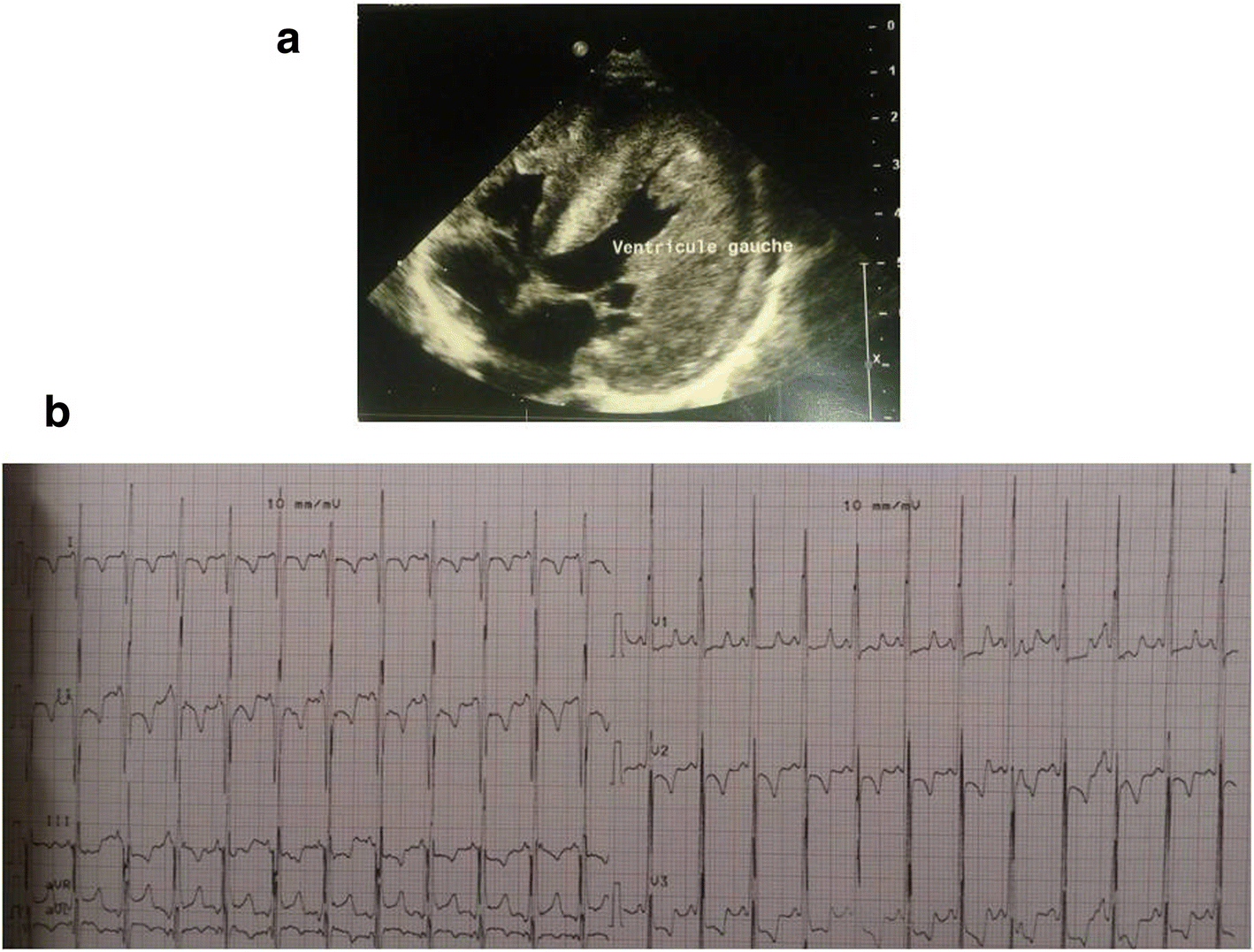 Fig. 1