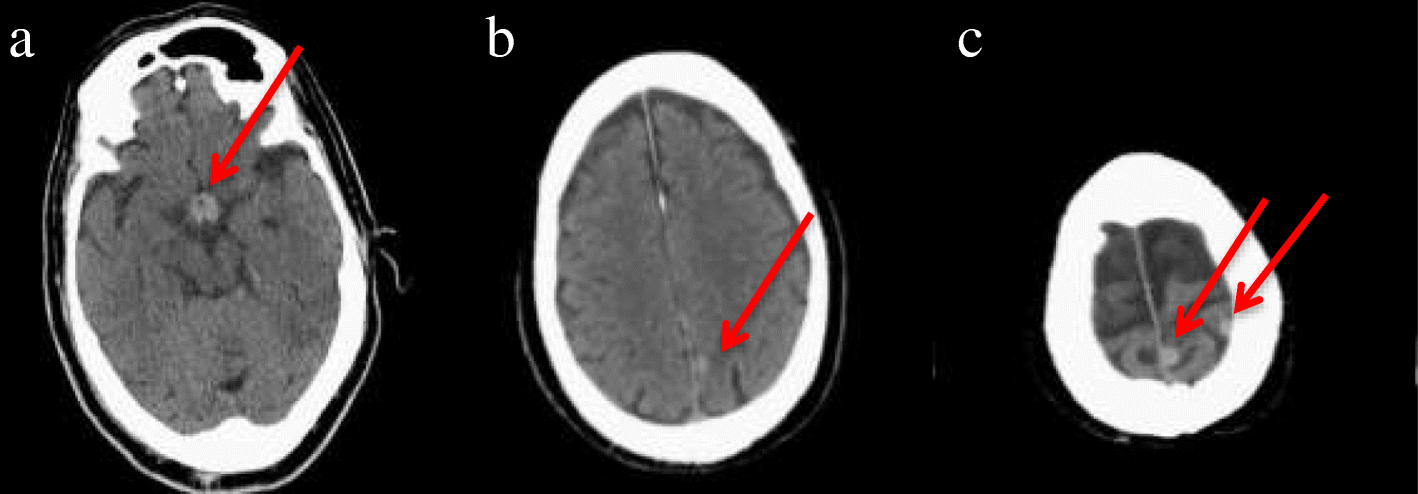 Fig. 1