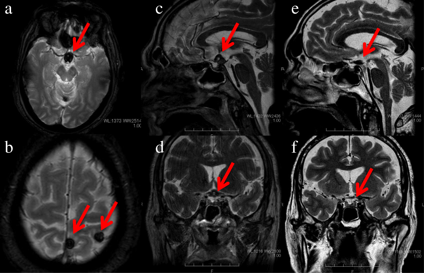 Fig. 2