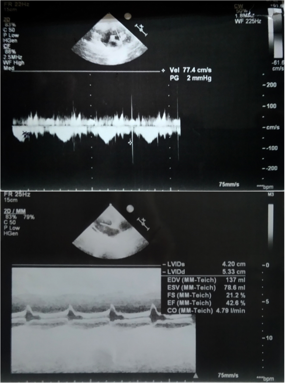 Fig. 2