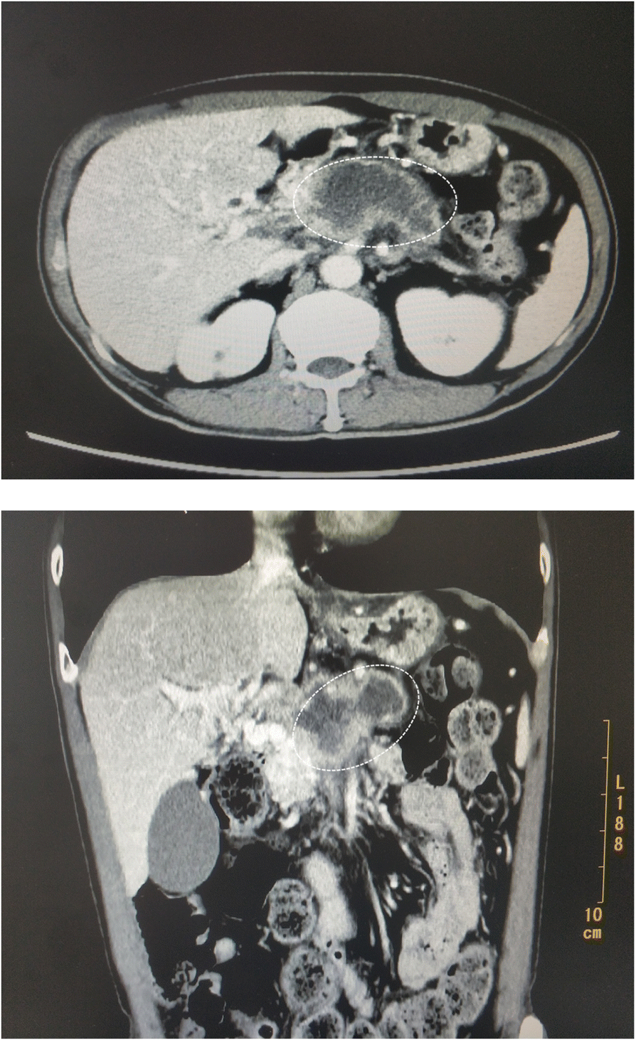 Fig. 1