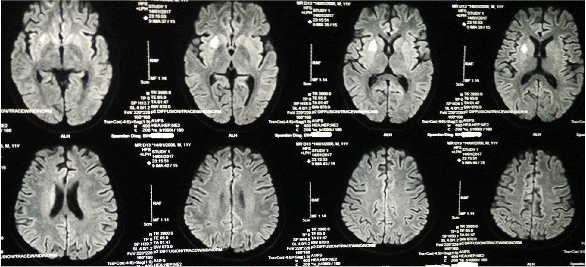 Fig. 2