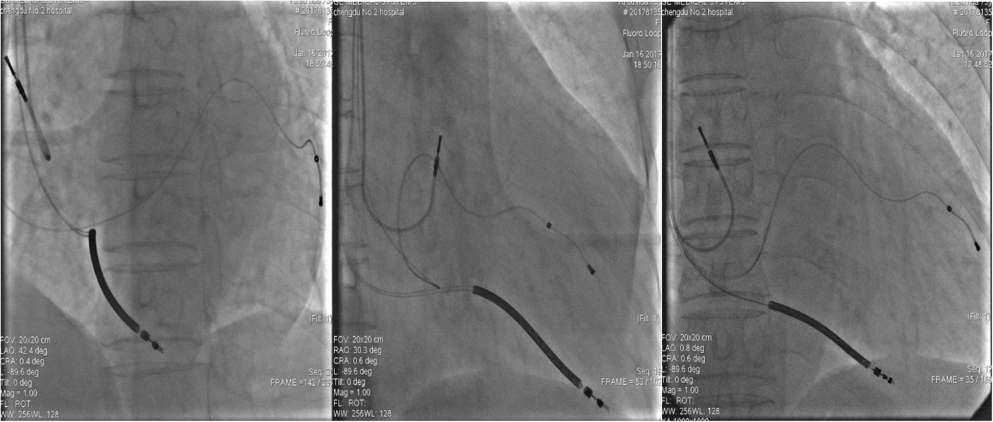 Fig. 3