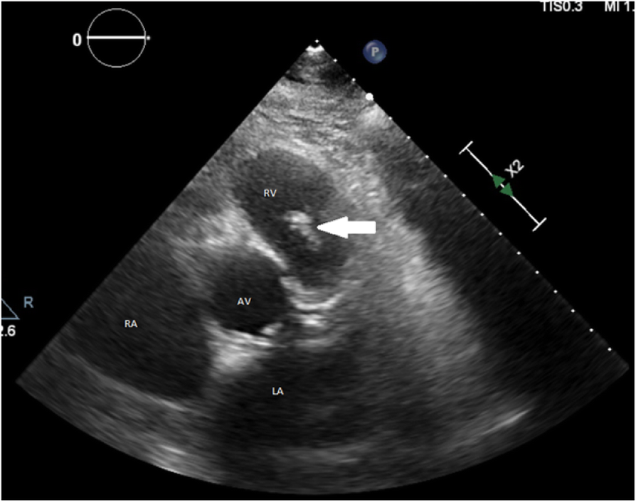 Fig. 1