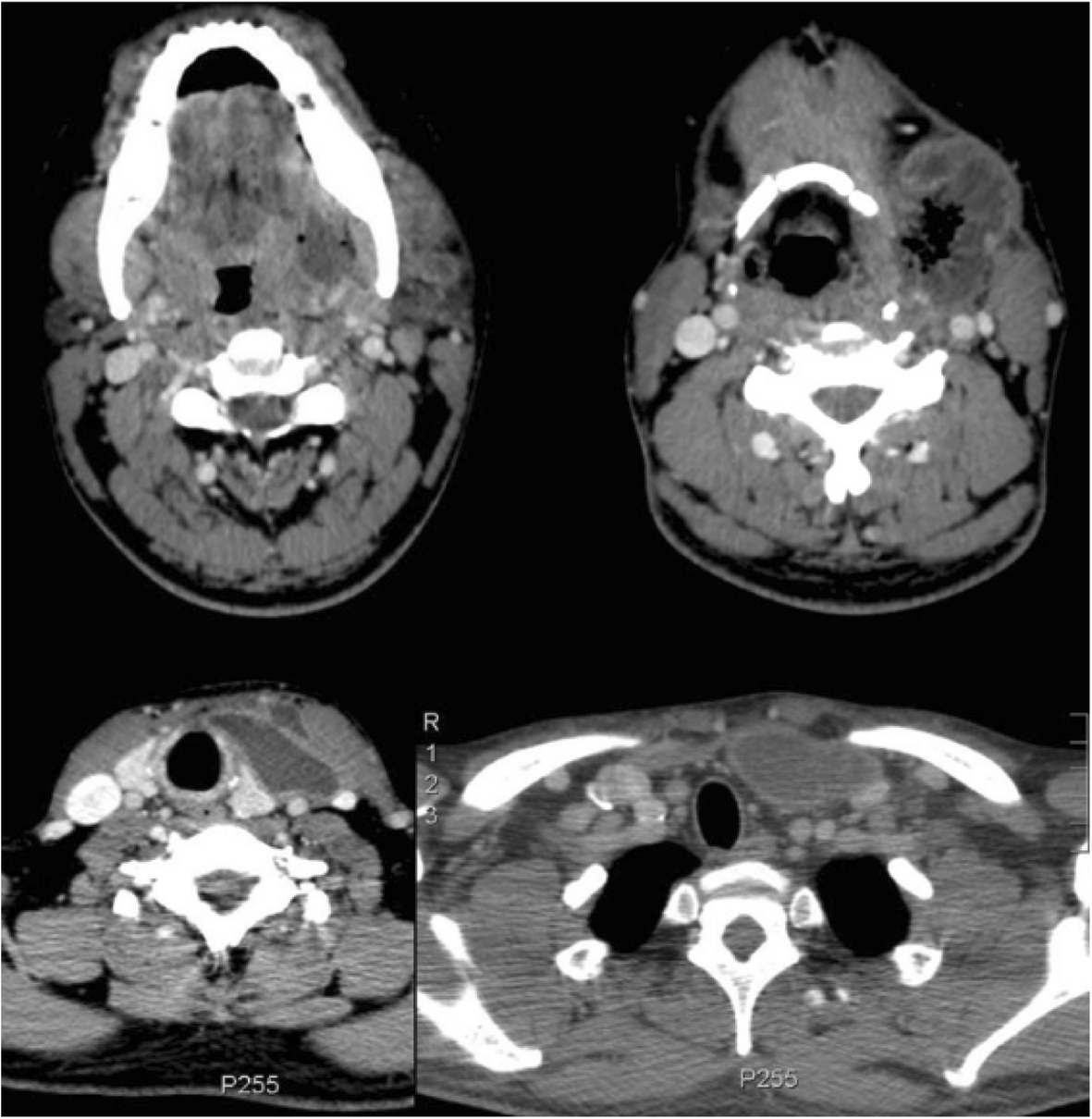 Fig. 1