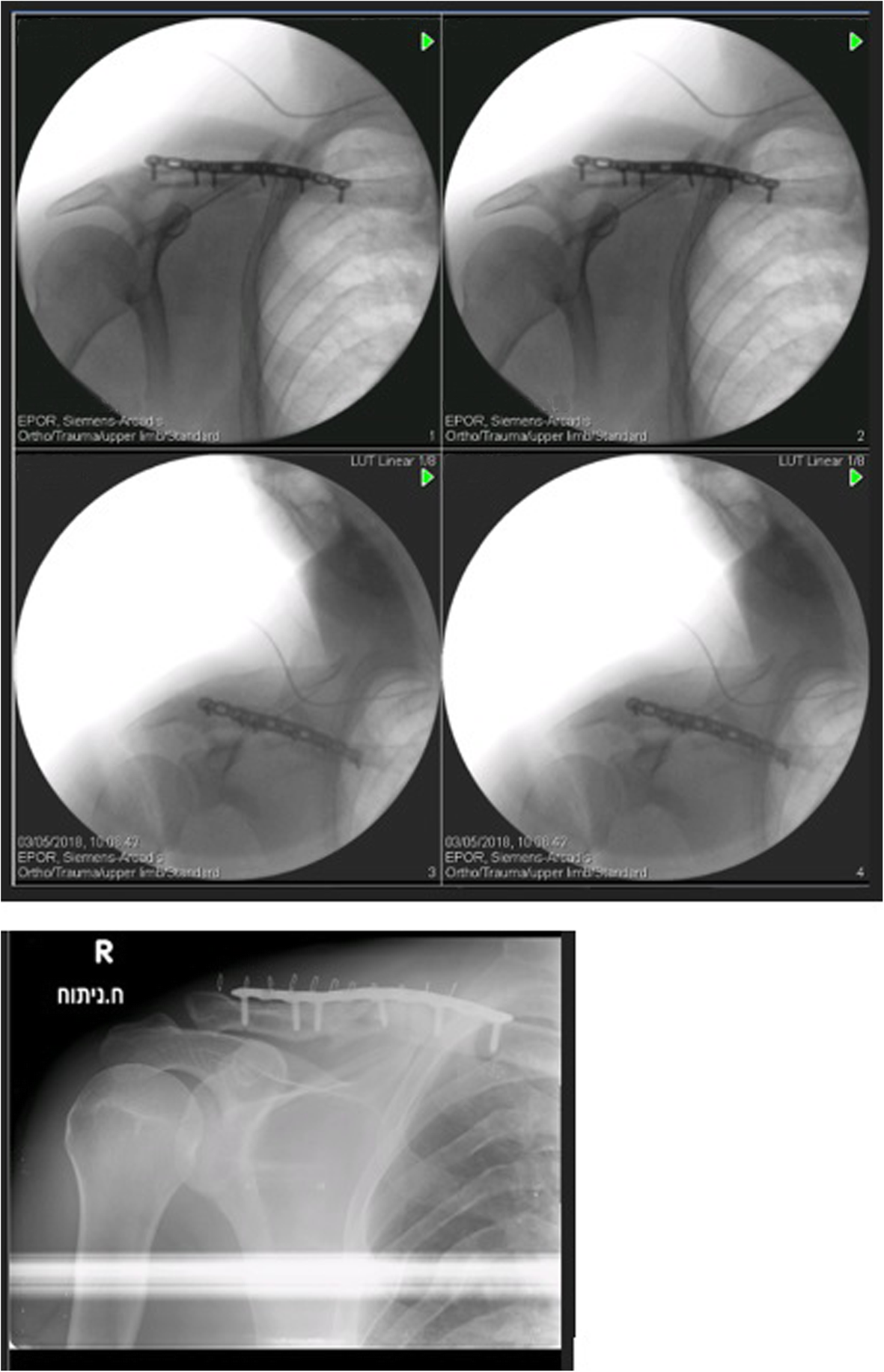 Fig. 4