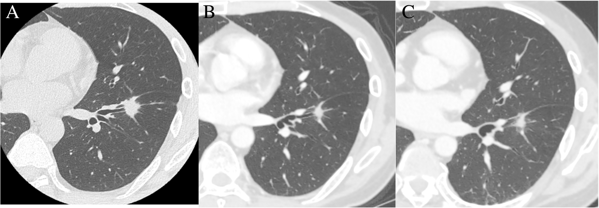 Fig. 2