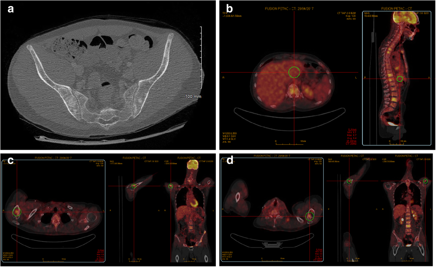 Fig. 1